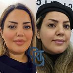 کلینیک تخصصی لیزر و لاغری اکتا(okta)