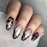 کاشت ترمیم تخصصی ناخن نیوشاکیان