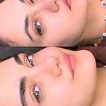 مرکز میکروبلیدینگ وفیبروز فرشته تقی زاده