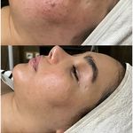 پاکسازی پوست و مو مهسام