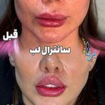 کلینیک زیبایی برنا