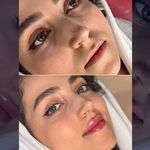 مجموعه زیبایی آتی‌ماه