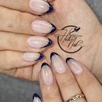 خدمات کاشت و ترمیم ناخن هدیه