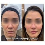 کلینیک زیبایی و لیزر مو زائد نوبا