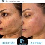 مرکز پاکسازی پوست کیمیا اسکین