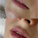 کلینیک پوست و زیبایی ژیلاوَش