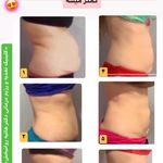 کلینیک تغذیه و رژیم درمانی و تناسب اندام (دکتر هانیه روانبخش)