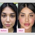 کلینیک پوست و زیبایی ژیلاوَش