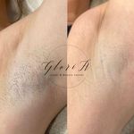 کلینیک زیبایی گلوریا