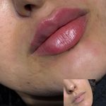 کلینیک پوست وزیبایی ومرکز تخصصی فیلربادی