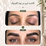 کلینیک زیبایی و لیزر مو زائد نوبا