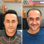 پیرایش نشاط