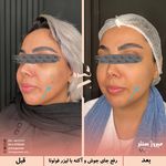 مرکز پزشکی و زیبایی میروژ سنتر