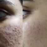 کلینیک زیبایی دکتر هدیه دهقانپور