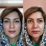 کلینیک زیبایی و لیزر دکتر آزاده اسماعیلی