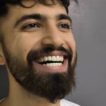 کامپوزیت ونیر