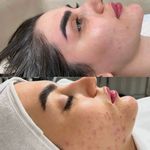 Skincare _eliamini
