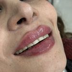 کلینیک پوست مو زیبایی و لیزر کهربا