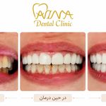 مطب دندانپزشکی آوینا