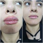 کلینیک زیبایی و لیزر مو گندم شرق تهران