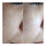 خدمات تخصصی پوست  سمیه اکرمی