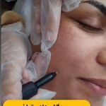 مرکز زیبایی بوتاکس و ژل و لیزر نایس