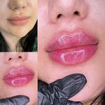 مطب زیبایی دکتر مهسا کاوئی