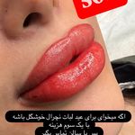 کلینیک تخصصی ناخن آران (افسریه)