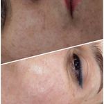 فیشیال / خدمات پوست / سالن زیبایی