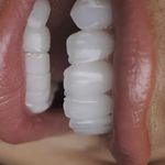 کلینیک‌دندانپزشکی دنتال آرنا-بیمه نیستیم