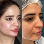 کلینیک پوست و مو موتاکس ملکی