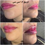 کلینیک زیبایی و لیزر مو گندم شرق تهران