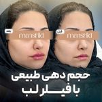 کلینیک زیبایی مانشید