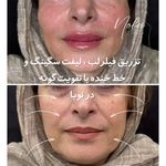 کلینیک زیبایی و لیزر مو زائد نوبا