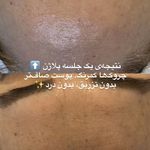 مرکز تخصصی فیشال و پاکسازی پوست حنانه