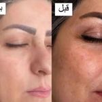 برای مشاوره یا تعیین قیمت تماس بگیرید