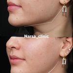 کلینیک پوست مو زیبایی فیلر بوتاکس نارسا