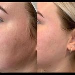 مرکز ماساژ و فیشال سارا