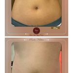 مرکز زیبایی رادا