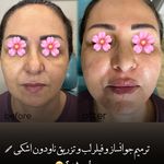 مرکز لیزر و کلینیک زیبایی پریفا
