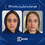 مرکز تخصصی زیبایی و جوانسازی دمور