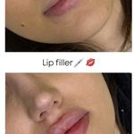 مرکز پوست، مو، زیبایی و لیزر هُلو