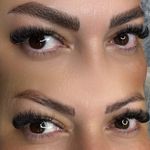 میکروکیماسی( میکروابرو چشم لب،ریمو)