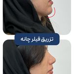 کلینیک زیبایی و جوانسازی پوست و مو الین