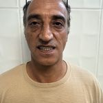 دندانسازی داود یارمحمدی