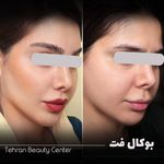 کلینیک زیبایی تهران بیوتی سنتر