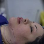 کلینیک زیبایی الماس کاملا اقساطی