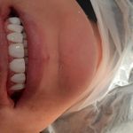 دندانپزشکی ایمپلنت و کلیه خدمات