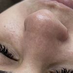 فیشال مراقبت از پوست پریناز گلستانی