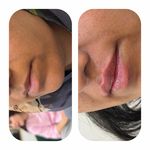 کلینیک تخصصی ژل و بوتاکس مرضیه آقابابایی
